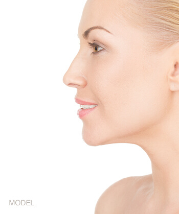 Juvederm feature image, model profile.