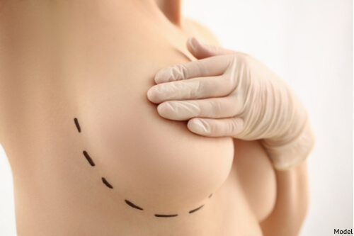 A woman at her consultation for a breast implant removal.