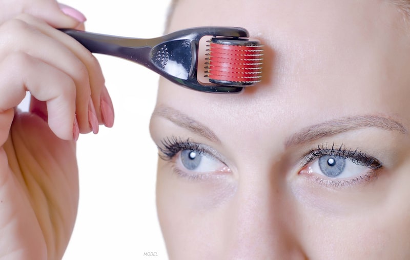 Woman using an at-home derma roller on her forehead. 